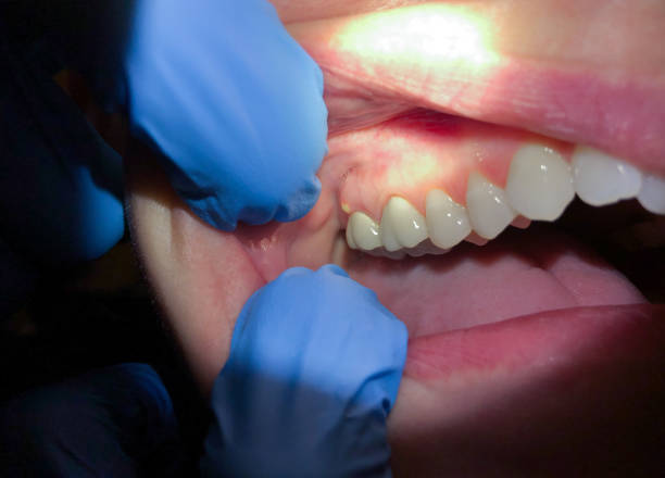 Best Emergency Treatment for Jaw Pain or Injury in Socastee, SC